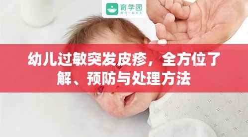 幼儿过敏突发皮疹,全方位了解、预防与处理方法