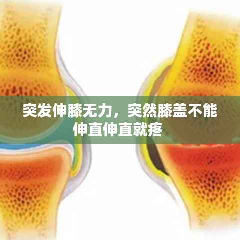 突发伸膝无力,突然膝盖不能伸直伸直就疼