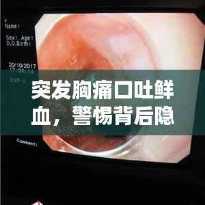 突发胸痛口吐鲜血,警惕背后隐藏的警示信号!