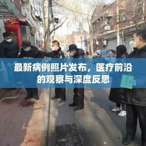 最新病例照片发布,医疗前沿的观察与深度反思